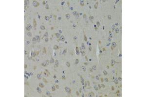 Immunohistochemistry of paraffin-embedded mouse brain using RPL9 Antibody. (RPL9 Antikörper  (AA 1-192))