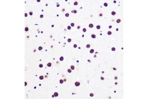 Immunohistochemistry of paraffin-embedded mouse brain using KHDRBS1/KHDRBS1/Sam68 Rabbit mAb (ABIN1680037, ABIN3018237, ABIN3018238 and ABIN7101585) at dilution of 1:100 (40x lens).