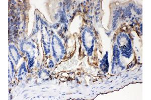 Anti- ABCB4 Picoband antibody, IHC(P) IHC(P): Mouse Intestine Tissue (ABCB4 Antikörper  (AA 601-720))