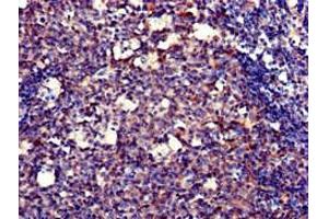Immunohistochemistry of paraffin-embedded human tonsil tissue using ABIN7150247 at dilution of 1:100 (POLH Antikörper  (AA 408-609))