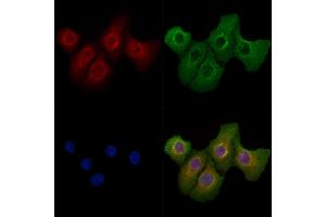 ABIN6262576 and ABIN6279541 staining Hela cells by IF/ICC.