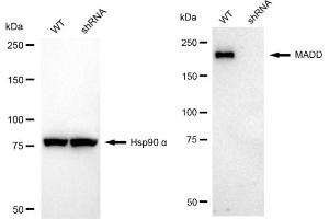 Western blotting analysis using MADD antibody (ABIN7799332).