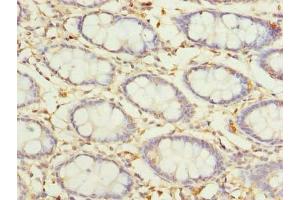 Immunohistochemistry of paraffin-embedded human colon tissue using ABIN7164641 at dilution of 1:100 (GLT25D2 Antikörper  (AA 351-626))