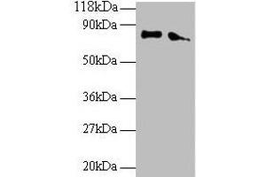 Western blot All lanes: ERP29 antibody at 2 μg/mL Lane 1: EC109 whole cell lysate Lane 2: 293T whole cell lysate Secondary Goat polyclonal to rabbit IgG at 1/15000 dilution Predicted band size: 29, 6 kDa Observed band size: 80 kDa (ERP29 Antikörper  (AA 40-251))