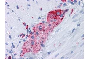Immunohistochemical analysis of paraffin-embedded human Small Intestine, myenteric plexus tissues using anti-SYP antibody (Synaptophysin Antikörper)