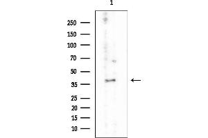 anti-SLC2A4 Regulator (SLC2A4RG) antibody