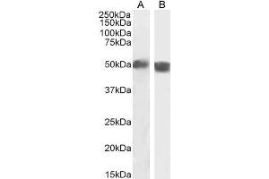 ABIN190840 (2µg/ml) staining of Human Spleen (A) and Mouse Thymus (B) lysate (35µg protein in RIPA buffer). (Carabin Antikörper  (Internal Region))