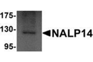 Western blot analysis of NALP14 in rat brain tissue lysate with NALP14 antibody at 1 μg/ml. (NLRP14 Antikörper  (N-Term))