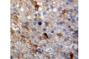 Used in DAB staining on fromalin fixed paraffin-embedded Liver tissue (GAP43 Antikörper  (AA 8-228))
