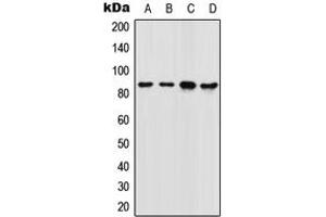 Western blot analysis of FOXM1 expression in SW480 (A), 22RV1 (B), NIH3T3 (C), rat colon (D) whole cell lysates. (FOXM1 Antikörper  (Center))