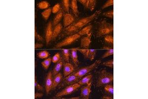 Immunofluorescence analysis of H9C2 cells using PSMD4 Rabbit pAb (ABIN3021329, ABIN3021330, ABIN3021331 and ABIN6214913) at dilution of 1:100. (PSMD4/ASF Antikörper  (AA 1-377))