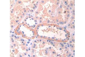 Used in DAB staining on fromalin fixed paraffin- embedded kidney tissue (LIFR Antikörper  (AA 692-833))