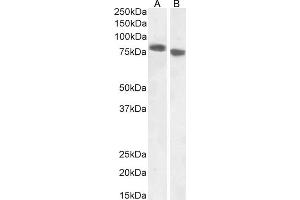 (ABIN238631) (1 μg/mL) staining of A431 (A) and (0. (EPB41L5 Antikörper  (Internal Region))