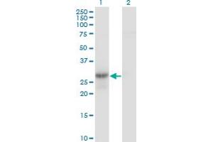 Western Blot analysis of GMNN expression in transfected 293T cell line by GMNN monoclonal antibody (M01), clone 1A8.