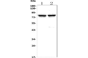 Western blot analysis of CHAT using anti-CHAT antibody (ABIN7600920).