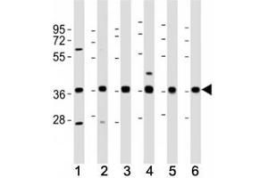 Western Blotting (WB) image for anti-MHC Class I Polypeptide-Related Sequence A (MICA) (AA 68-97) antibody (ABIN3031773)