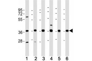 Western blot testing of MICA antibody at 1:2000 dilution. (MICA Antikörper  (AA 68-97))