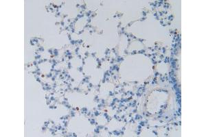 Immunohistochemistry (IHC) image for anti-DNA Fragmentation Factor, 45kDa, alpha Polypeptide (DFFA) (AA 19-262) antibody (ABIN5013466)