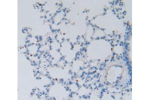 Used in DAB staining on fromalin fixed paraffin- embedded Kidney tissue (DFFA Antikörper  (AA 19-262))