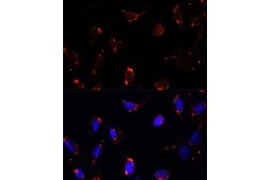 Immunofluorescence (IF) image for anti-Transforming Growth Factor beta Regulator 4 (TBRG4) (AA 382-631) antibody (ABIN7270907)