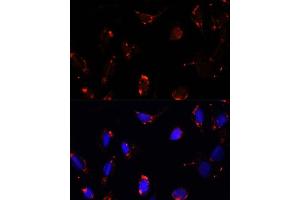 Immunofluorescence analysis of U-2 OS cells using TBRG4 antibody  at dilution of 1:100. (TBRG4 Antikörper  (AA 382-631))