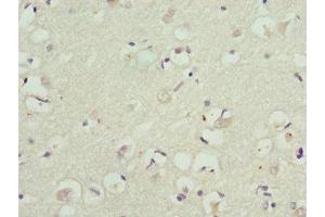 Immunohistochemistry of paraffin-embedded human brain tissue using ABIN7157744 at dilution of 1:100 (KCNIP2 Antikörper  (AA 1-90))