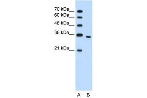 WB Suggested Anti-PRPS2  Antibody Titration: 1. (PRPS2 Antikörper  (N-Term))