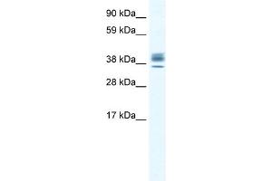 WB Suggested Anti-ESX1 Antibody Titration:  2. (ESX Homeobox 1 Antikörper  (N-Term))