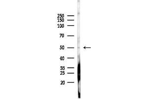anti-Low Density Lipoprotein Receptor Related Protein 11 (LRP11) (Internal Region) antibody