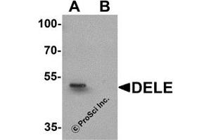 Western Blotting (WB) image for anti-DAP3 Binding Cell Death Enhancer 1 (DELE1) (N-Term) antibody (ABIN1031350) (DELE1/KIAA0141 Antikörper  (N-Term))