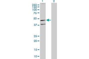 Western Blot analysis of CXCR5 expression in transfected 293T cell line by CXCR5 MaxPab polyclonal antibody. (CXCR5 Antikörper  (AA 1-372))