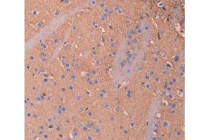 IHC-P analysis of brain tissue, with DAB staining. (IL18BP Antikörper  (AA 29-193))