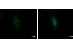 ICC/IF Image CD99L2 antibody detects CD99L2 protein at Cell membrane by immunofluorescent analysis. (CD99L2 Antikörper)