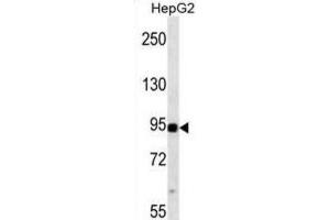 Western Blotting (WB) image for anti-Mitogen-Activated Protein Kinase Kinase Kinase 11 (MAP3K11) antibody (ABIN2938456) (MAP3K11 Antikörper)