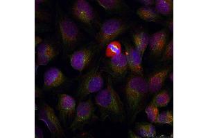 Immunofluorescence staining of methanol-fixed HeLa cells using Phospho-NFKB1-S337 antibody (ABIN2987371). (NFKB1 Antikörper  (pSer337))