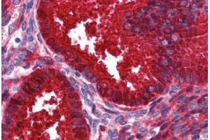 Human Uterus: Formalin-Fixed, Paraffin-Embedded (FFPE) (SERPING1 Antikörper  (AA 1-501))