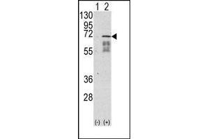 Western Blotting (WB) image for anti-Activin Receptor Type I (ACRV1) (Middle Region) antibody (ABIN359222)