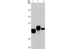 Gel: 6 % SDS-PAGE, Lysate: 40 μg, Lane 1-3: Human placenta tissue, Human fetal liver tissue, HepG2 cells, Primary antibody: ABIN7192345(SGK2 Antibody) at dilution 1/100, Secondary antibody: Goat anti rabbit IgG at 1/8000 dilution, Exposure time: 8 minutes (SGK2 Antikörper)