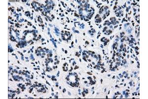Immunohistochemical staining of paraffin-embedded breast tissue using anti-L1CAM mouse monoclonal antibody.