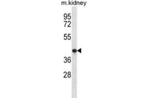 Western Blotting (WB) image for anti-Tenomodulin (TNMD) antibody (ABIN2996886) (TNMD Antikörper)
