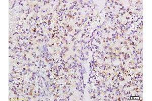 Immunohistochemistry (IHC) image for anti-Fc Fragment of IgG, Low Affinity IIb, Receptor (CD32) (FCGR2B) (pTyr292) antibody (ABIN761411)
