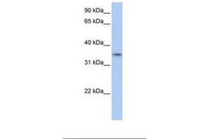 GID4 Antikörper  (C-Term)