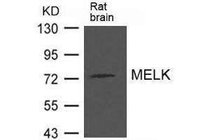 Western blot analysis of extract from Rat brain tissue using MELK Antibody (MELK Antikörper)