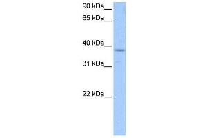 PCBP1 antibody used at 1 ug/ml to detect target protein. (PCBP1 Antikörper)