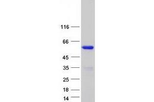 Western Blotting (WB) image for Double C2-Like Domains, beta (DOC2B) protein (Myc-DYKDDDDK Tag) (ABIN2719628)