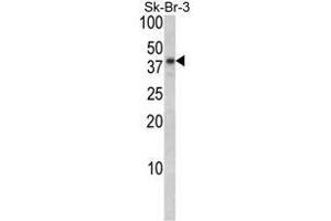 Image no. 1 for anti-Biglycan (BGN) (AA 155-184), (Middle Region) antibody (ABIN452781) (Biglycan Antikörper  (Middle Region))