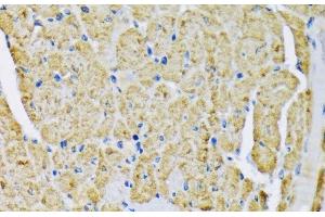 Immunohistochemistry of paraffin-embedded Mouse heart using HK2 Polyclonal Antibody at dilution of 1:200 (40x lens). (Hexokinase 2 Antikörper)
