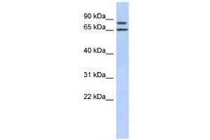Image no. 1 for anti-Fibrous Sheath Interacting Protein 1 (FSIP1) (AA 287-336) antibody (ABIN6741216) (FSIP1 Antikörper  (AA 287-336))