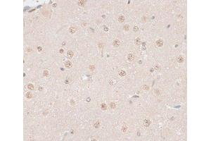 Immunohistochemistry of paraffin-embedded Mouse brain using HMGN1 Polyclonal Antibody at dilution of 1:100 (40x lens). (HMGN1 Antikörper)