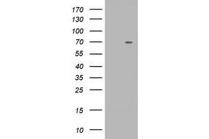 Western Blotting (WB) image for anti-Tripartite Motif Containing 2 (TRIM2) (AA 1-100), (AA 645-744) antibody (ABIN1490542)